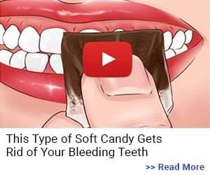 ProDentim helps get rid of bleeding teeth, naturally and effectively.